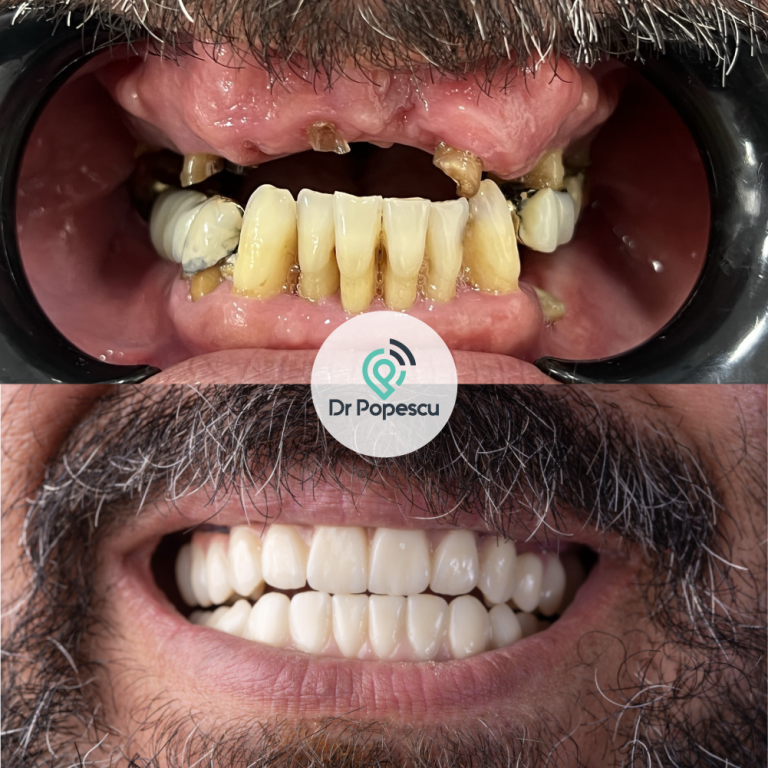 DrPopescu-Testimonials-5