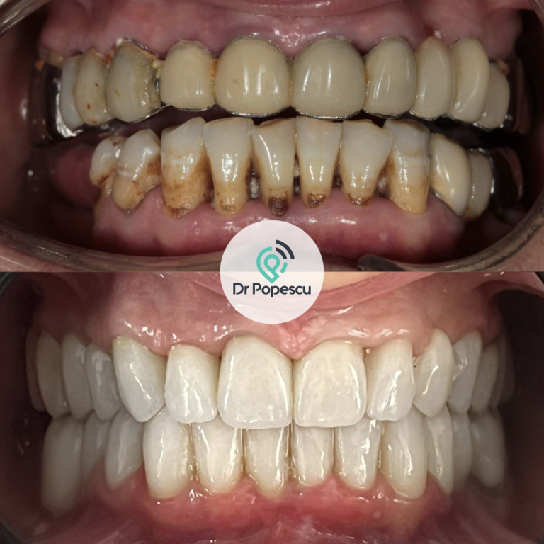 DrPopescu-Testimonials-7