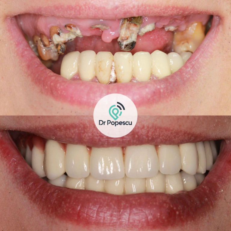 DrPopescu-Testimonials-8