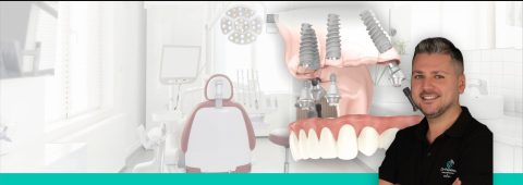 Implant dentar București, Clinica Dr Popescu